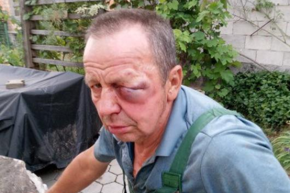 Nov napad Romov: člani družine Strojan naj bi brutalno pretepli 72-letnika (foto: Facebook/Anja Bah Žibert)