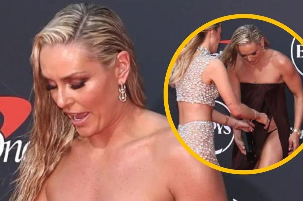 Lindsey Vonn pokazala več, kot je želela: ponosno pozirala fotografom, nato pa ... (FOTO) (foto: Twitter/nypost/fotomontaža)