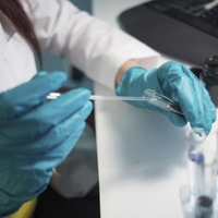 virus hiv zdravniki zdravilo odkritje preboj zdravje