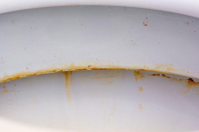 Kako za vedno odstraniti rumene madeže v WC školjki? To je trik naših babic, ki nadomesti vsa draga čistila