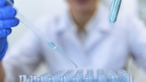 kaca strup zdravnik zdrastvo protistrup laboratorij odkritje zivljenje smrt