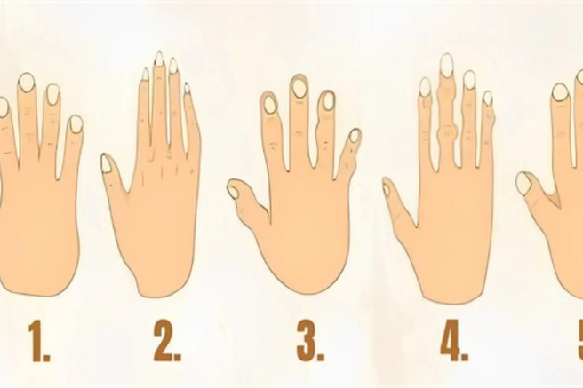 Kakšno roko imate? Oblika razkriva skrite plati vaše osebnosti