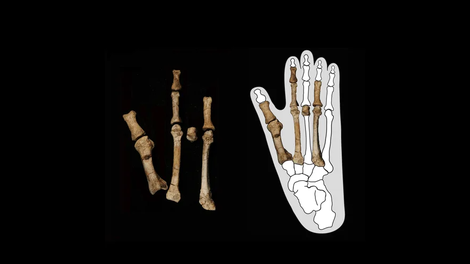 Yohannes Haile-Selassie Etiopija Stopalo zgodovina človeštvo razvoj evolucija znanost najdba odkritje