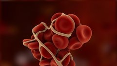 Kako prepoznate krvni strdek v telesu? Ne spreglejte teh 8 opozorilnih znakov