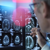 rak celice zombi znanost odkritje medicina zdravje