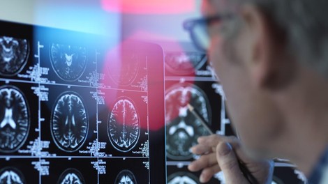 rak celice zombi znanost odkritje medicina zdravje