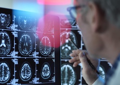 Medicina dobiva bitko z rakom?! Presunljivo razkritje znanstvenikov: nekaj v naših telesih uspešno kljubuje smrti!