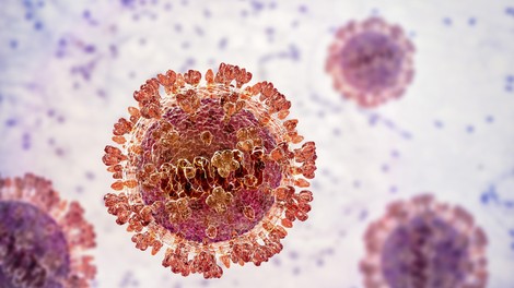 virus nipah