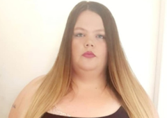 Osupljiva preobrazba: po ulici komaj hodila s palico, zdaj se moški slinijo okrog nje in njene sanjske postave (FOTO)