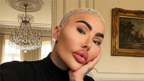 'Kralj ustnic' umrl pri 34 letih: policija aretirala dve osebi