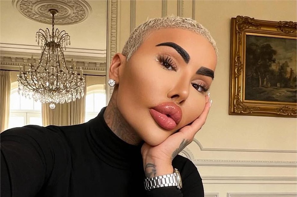 'Kralj ustnic' umrl pri 34 letih: policija aretirala dve osebi (foto: Instagram/jordanjamesparke2)