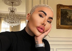 'Kralj ustnic' umrl pri 34 letih: policija aretirala dve osebi