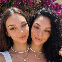 Siamski dvojčici, ki sta obnoreli svet: vsi se sprašujejo zgolj eno stvar in jasno je, da je nekaj hudo narobe