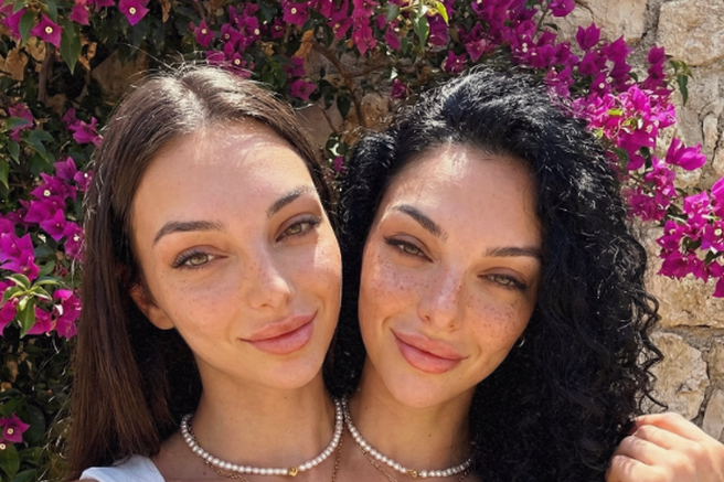 Siamski dvojčici, ki sta obnoreli svet: vsi se sprašujejo zgolj eno stvar in jasno je, da je nekaj hudo narobe