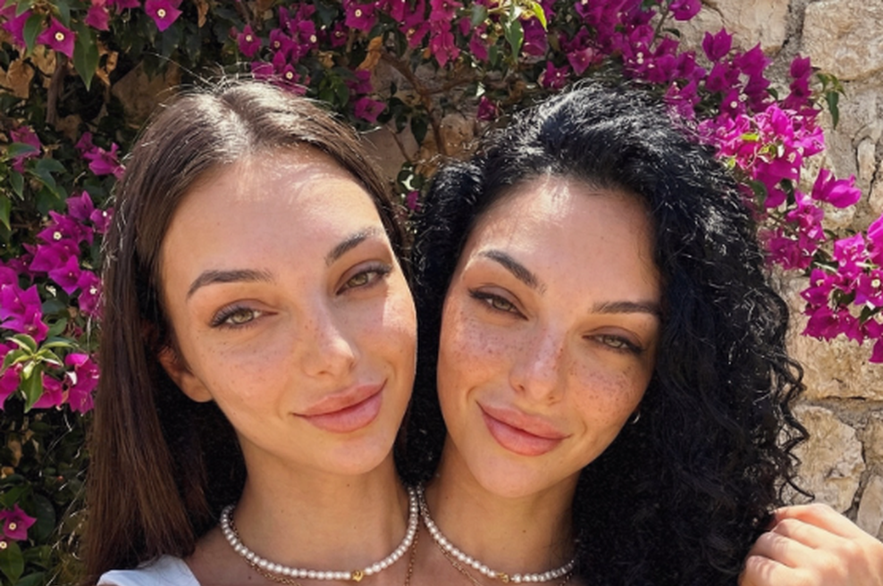 Siamski dvojčici, ki sta obnoreli svet: vsi se sprašujejo zgolj eno stvar in jasno je, da je nekaj hudo narobe (foto: Instagram/itsvaleriaandcamila)