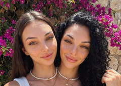 Siamski dvojčici, ki sta obnoreli svet: vsi se sprašujejo zgolj eno stvar in jasno je, da je nekaj hudo narobe