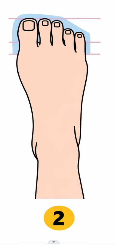 2 Rimska oblika stopala (prvi trije prsti, vključno s palcem, so enake dolžine, medtem ko sta četrti in peti prst …