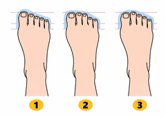 Kakšno obliko stopala imate? Test, ki razkrije, kdo ste v resnici