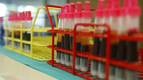 krvodajalska akcija slovenija kri darovanje zdravje pomoc