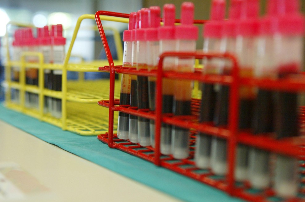 Začenja se vseslovenska akcija: s pol litra postanite junak dneva (foto: Petar Perić / Bobo)