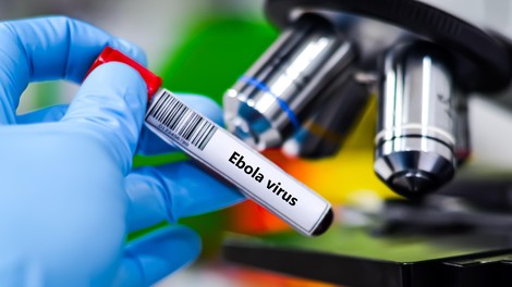 ebola