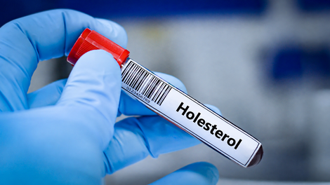 holesterol