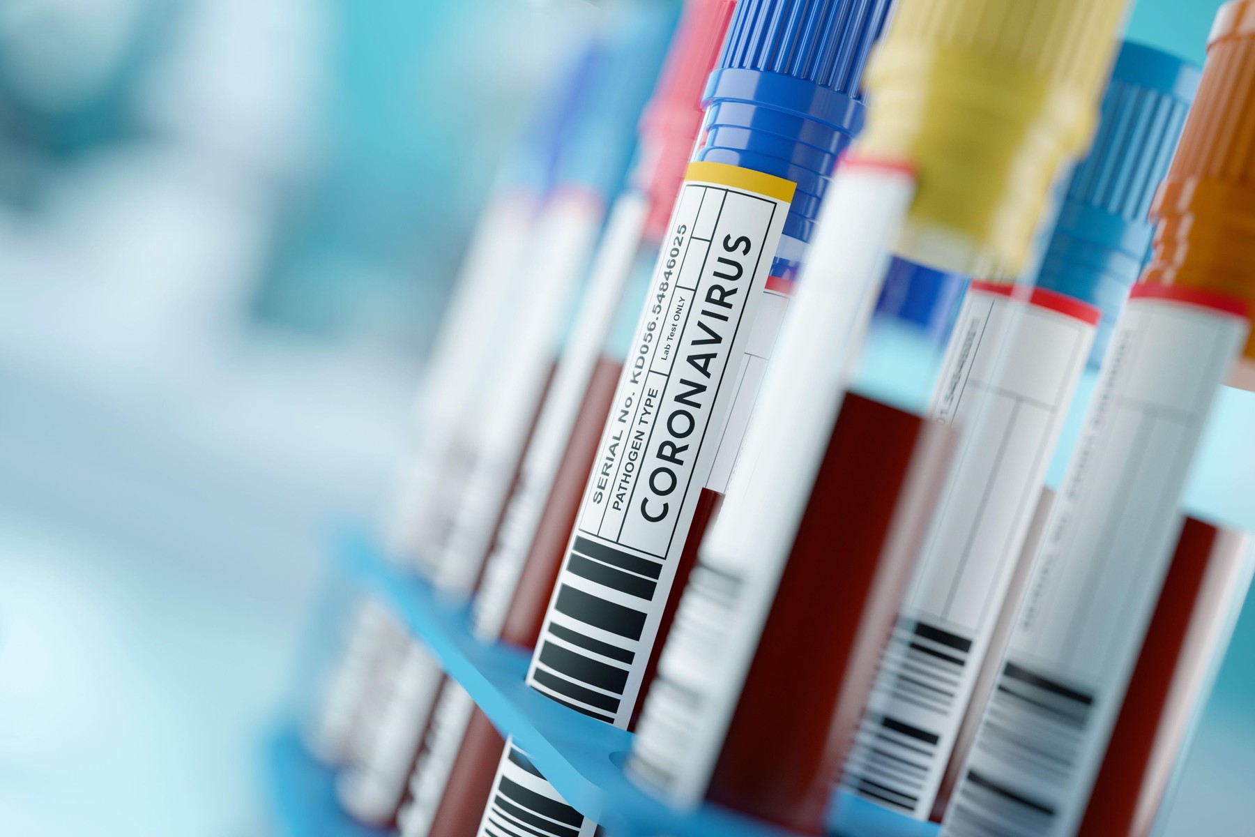 coronavirus