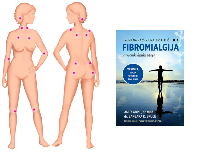 fibromialgija